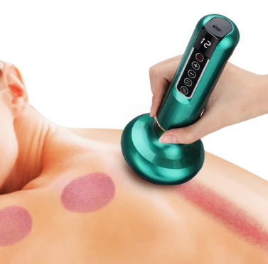 Gua-Sha- & Schröpftherapie